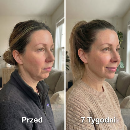 LymphaLift Pro