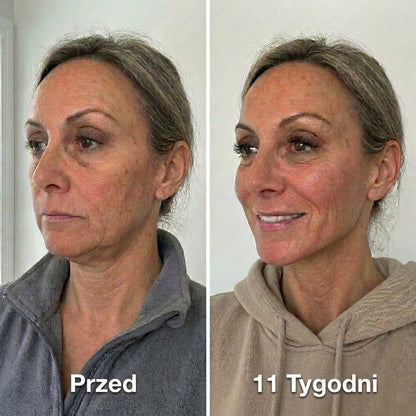 LymphaLift Pro